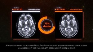 Deep Resolve Boost - МРТ исследование всего за 2 минуты