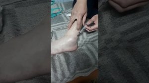 ТРАВМА НОГИ / ПЫТАЛСЯ ОТКАЧАТЬ КРОВЬ ИЗ ГЕМАТОМЫ, А ТАМ ВОЗДУХ😁