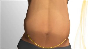 Tummy tuck, Testimonial and tips. Plastic surgery in Mexico.