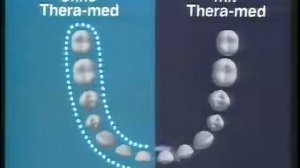Theramed Zahncreme Werbung 1985