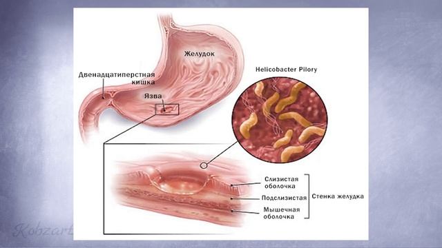 Как похудеть. Первое что нужно - это АНАЛИЗЫ смотреть онлайн