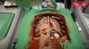 SURGEON SIMULATOR: Как НЕ НАДО оперировать?