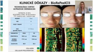 WEBINÁR časť 2 - BIOREPEELCL3-Dvojfázová technológia