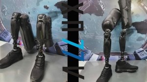 Парная ампутация. ALLUX.