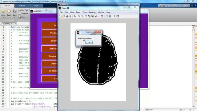 mri brain 3d reconstruction matlab PROJECTS