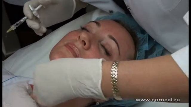 Показания определяют зону процедуры биоревитализации