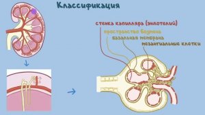 Люпус (волчаночный) нефрит, патофизиология, диагностика, лечение