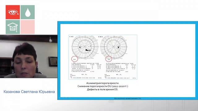 Казанова. Подозрение на глаукому Нюансы диагностики смотреть онлайн