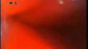 Удаление инородного предмета из желудка собаки