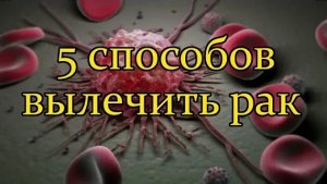 5 СПОСОБОВ ВЫЛЕЧИТЬ РАК (сок, сода, голодание, паразиты для лечения рака)