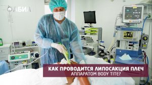 Как проводится радиочастотная липосакция плеч аппаратом Body Tite? ?