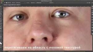 Удалить родинку на лице Фотошоп/Photoshop