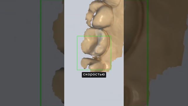 Alliedstar AS100 один из новейших интраоральных 3D сканеров #cadcam #интраоральный3dсканер #cadcam3d