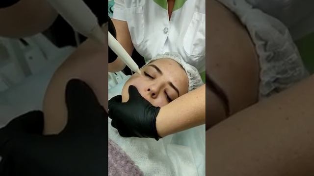 Метод холодной плазмы на аппарате ГЕЛИОС.