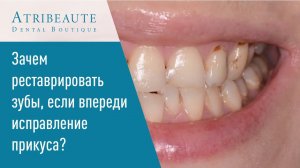  Зачем реставрировать зубы, если впереди исправление прикуса?