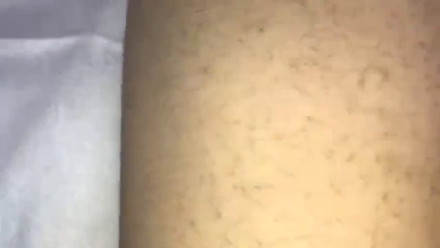 Лазерная эпиляция. Руки смотреть онлайн