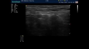 Глубокие вены нижней конечности.
