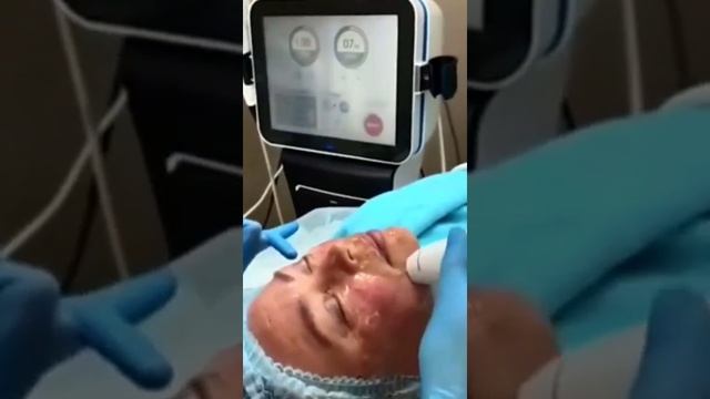 лифтера смотреть онлайн