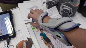 Восстановление кисти после инсульта - Электростимуляция