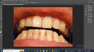 Whiten Teeth in Photoshop SUPER EASY