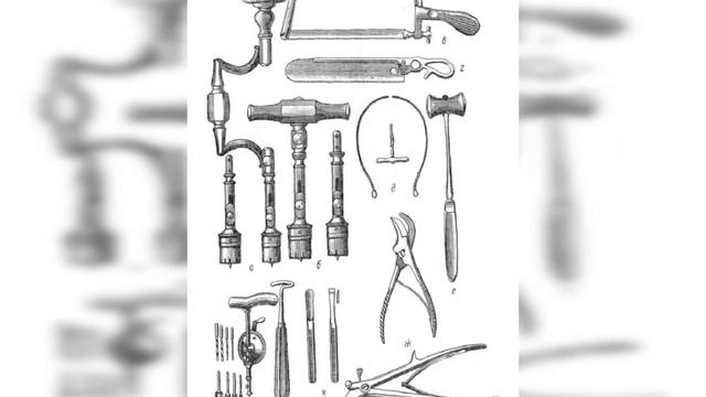Трепанация черепа смотреть онлайн