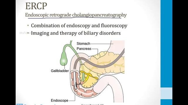 Гастроэнтерология USMLE - 3. Клиническая гастроэнтерология - 10.Острый панкреатит