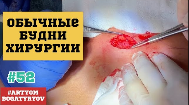 52. Будни хирургии