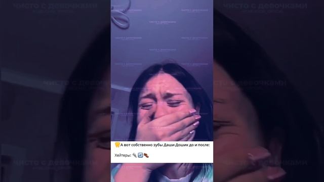 зубы Даши Дошик до и после