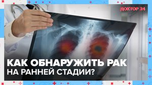 Как обнаружить РАК на ранней стадии? | Доктор 24