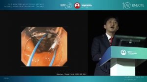Endoscopic submucosal dissection of early colorectal neoplsms with a monopolar scissor -type knife