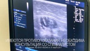 Лечение варикозного расширения вен в Клинике Константа г. Вологда