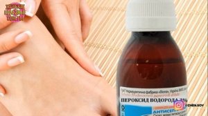 Перекись Водорода Будет Незаменимым Средством, Когда Вы Узнаете Это!