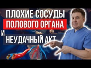 ПЛОХИЕ сосуды полового органа. Как ИСПРАВИТЬ