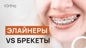 Элайнеры или брекеты: что лучше?