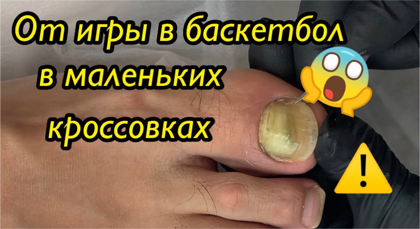 От игры в баскетбол в маленьких кроссовках?⚠️?❗️??