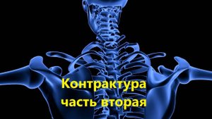 КОНТРАКТУРА. Часть 2. Механизм - осуществляющий ограничение в движении сустава.