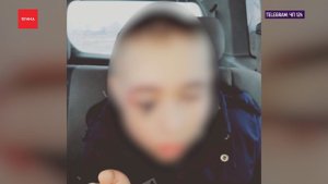 Бродячая собака покусала ребенка в Канском районе