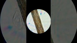 Человеческий волос под микроскопом