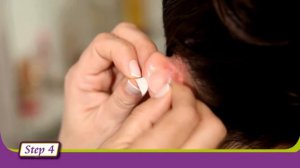 Отостик - эстетический корректор для ушей