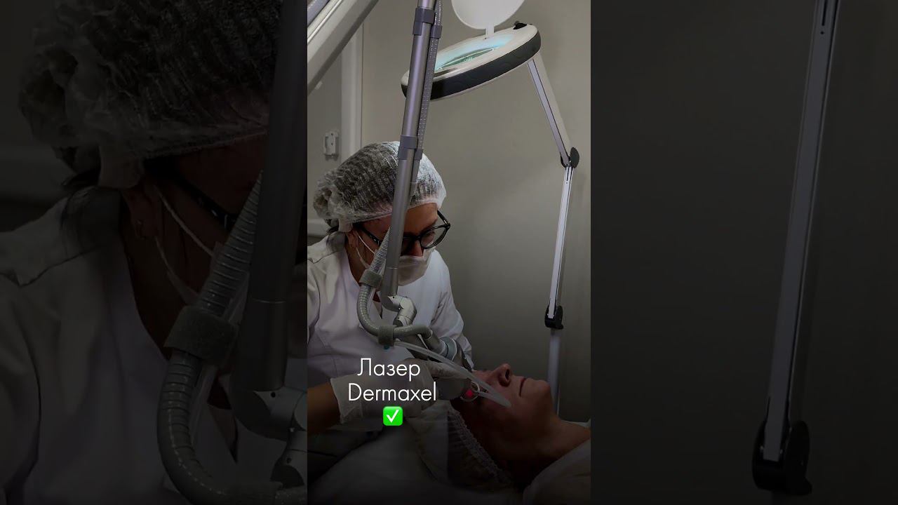 Лазерное ОМОЛОЖЕНИЕ ВЕК с эффектом блефаропластики смотреть онлайн