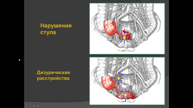 Клиническая картина и диагностика острого аппендицита