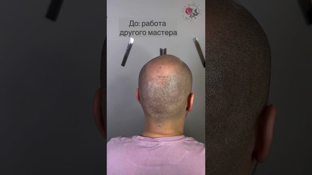Исправление работы другого мастера, трихопигментация, татуировка волос от облысения. SMP