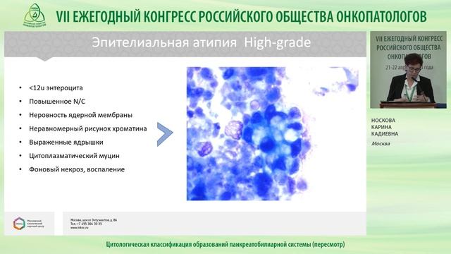 Цитологическая классификация образований панкреатобилиарной системы (пересмотр)