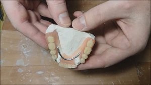 Ремонт съемного зубного протеза своими руками. Армирование. Repair of dental acrylic prosthesis.