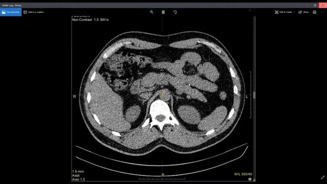 Сохранение снимков и фрагментов для экспорта в Vidar Dicom Viewer смотреть онлайн