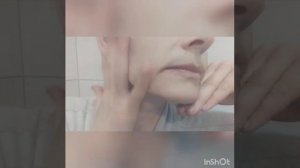 ПИЯВКИ. КОСМЕТИЧЕСКАЯ ПОСТАНОВКА НА ОВАЛ ЛИЦА