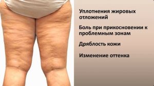 Последняя Стадия Целлюлита. Полезно Знать!