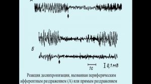 ЭЭГ Электроэнцефалография  Лекция 1
