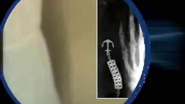 Вильгельм Конрад Рентген.mp4 смотреть онлайн