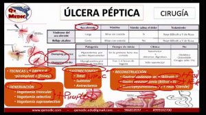 Qx gastroenterologia - 471651495